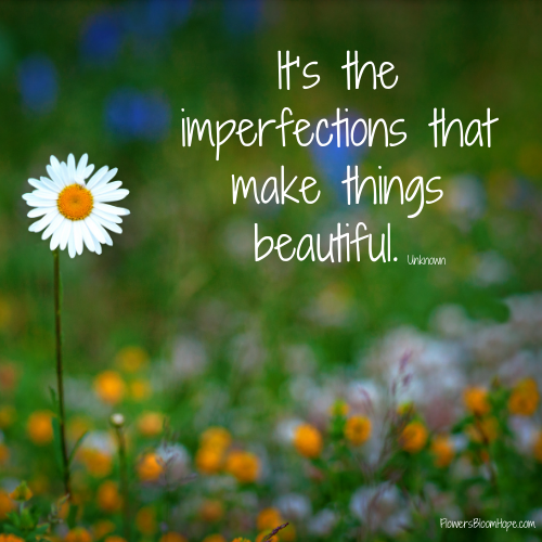 It’s the imperfections that make things beautiful.